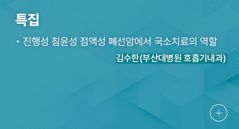 특집