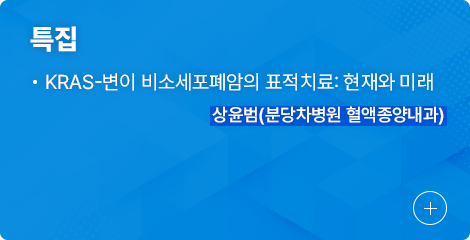 특집